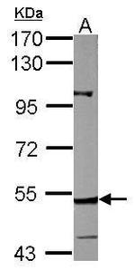 CYP27A1 Antibody in Western Blot (WB)