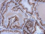 EWSR1 Antibody in Immunohistochemistry (Paraffin) (IHC (P))