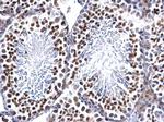 EWSR1 Antibody in Immunohistochemistry (Paraffin) (IHC (P))