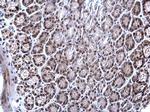 EWSR1 Antibody in Immunohistochemistry (Paraffin) (IHC (P))