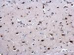 EWSR1 Antibody in Immunohistochemistry (Paraffin) (IHC (P))