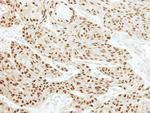 EWSR1 Antibody in Immunohistochemistry (Paraffin) (IHC (P))