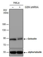 Gelsolin Antibody