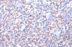 HLA-A Antibody in Immunohistochemistry (Paraffin) (IHC (P))