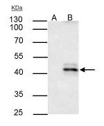 HLA-A Antibody in Immunoprecipitation (IP)