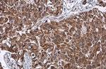 HSD3B1 Antibody in Immunohistochemistry (Paraffin) (IHC (P))