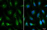 ROBO1 Antibody in Immunocytochemistry (ICC/IF)