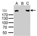 ROBO1 Antibody in Western Blot (WB)