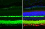 Synaptotagmin 1 Antibody in Immunohistochemistry (Paraffin) (IHC (P))