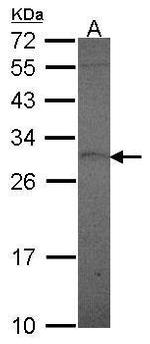 Prolactin Antibody in Western Blot (WB)