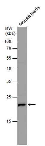 RAN Antibody in Western Blot (WB)