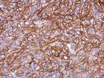 HLA-B Antibody in Immunohistochemistry (Paraffin) (IHC (P))