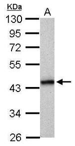 HLA-B Antibody in Western Blot (WB)