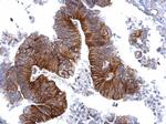 gamma Catenin Antibody in Immunohistochemistry (Paraffin) (IHC (P))