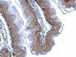 gamma Catenin Antibody in Immunohistochemistry (Paraffin) (IHC (P))