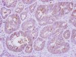 Calcineurin B Antibody in Immunohistochemistry (Paraffin) (IHC (P))