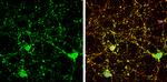 Calcineurin B Antibody in Immunocytochemistry (ICC/IF)