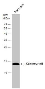 Calcineurin B Antibody in Western Blot (WB)