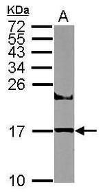 UBE2A Antibody in Western Blot (WB)