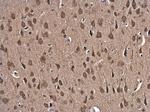 GSR Antibody in Immunohistochemistry (Paraffin) (IHC (P))