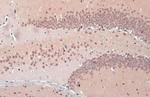 TDP-43 Antibody in Immunohistochemistry (Paraffin) (IHC (P))