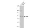 GAB2 Antibody in Western Blot (WB)