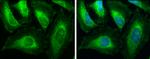 ACAA1 Antibody in Immunocytochemistry (ICC/IF)