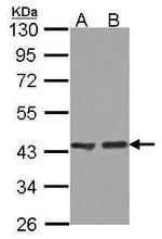 ACAA1 Antibody in Western Blot (WB)