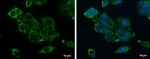 SBCAD Antibody in Immunocytochemistry (ICC/IF)