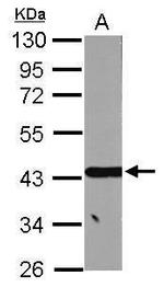 SBCAD Antibody in Western Blot (WB)