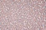 ACADVL Antibody in Immunohistochemistry (Paraffin) (IHC (P))