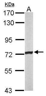 ACADVL Antibody in Western Blot (WB)