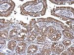 Aconitase 2 Antibody in Immunohistochemistry (Paraffin) (IHC (P))