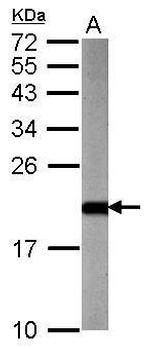 ARF3 Antibody in Western Blot (WB)