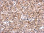 Asparagine Synthetase Antibody in Immunohistochemistry (Paraffin) (IHC (P))