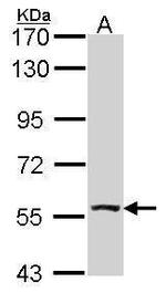 ALDH7A1 Antibody in Western Blot (WB)