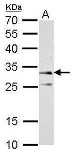 ATP Synthase gamma Antibody in Western Blot (WB)