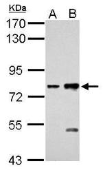 K-cadherin Antibody in Western Blot (WB)