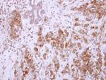 CHAD Antibody in Immunohistochemistry (Paraffin) (IHC (P))