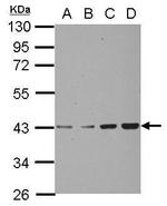 CHAD Antibody in Western Blot (WB)