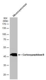 Carboxypeptidase B1 Antibody in Western Blot (WB)