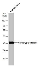 Carboxypeptidase B1 Antibody in Western Blot (WB)