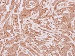 CPT1A Antibody in Immunohistochemistry (Paraffin) (IHC (P))