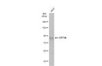 CPT1A Antibody in Western Blot (WB)