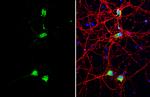 CUX1/Protein CASP Antibody in Immunocytochemistry (ICC/IF)