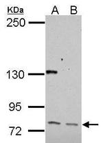 CUX1/Protein CASP Antibody in Western Blot (WB)