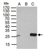 DTYMK Antibody in Immunoprecipitation (IP)