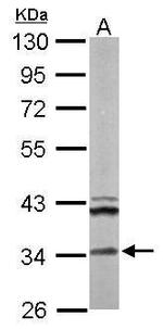 ECH1 Antibody in Western Blot (WB)