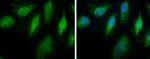 ECHS1 Antibody in Immunocytochemistry (ICC/IF)