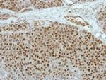 ETV5 Antibody in Immunohistochemistry (Paraffin) (IHC (P))